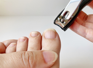 間違った爪の切り方が巻き爪の原因に