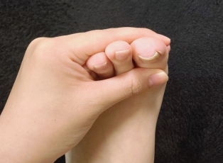 切らない痛くない巻き爪施術